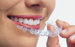 clear braces in Orem and Provo