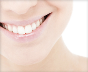 smile makeover candidates for porcelain veneers with a Provo dentist Orem Utah County