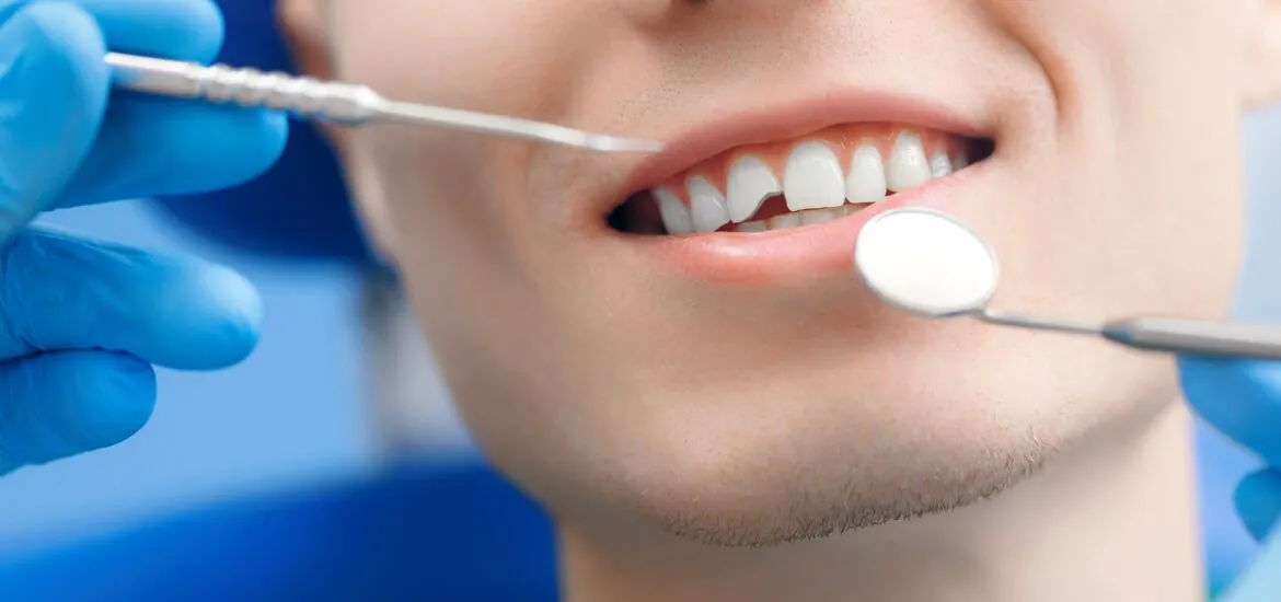 closeup of dentist in blue gloves examining a chipped front tooth