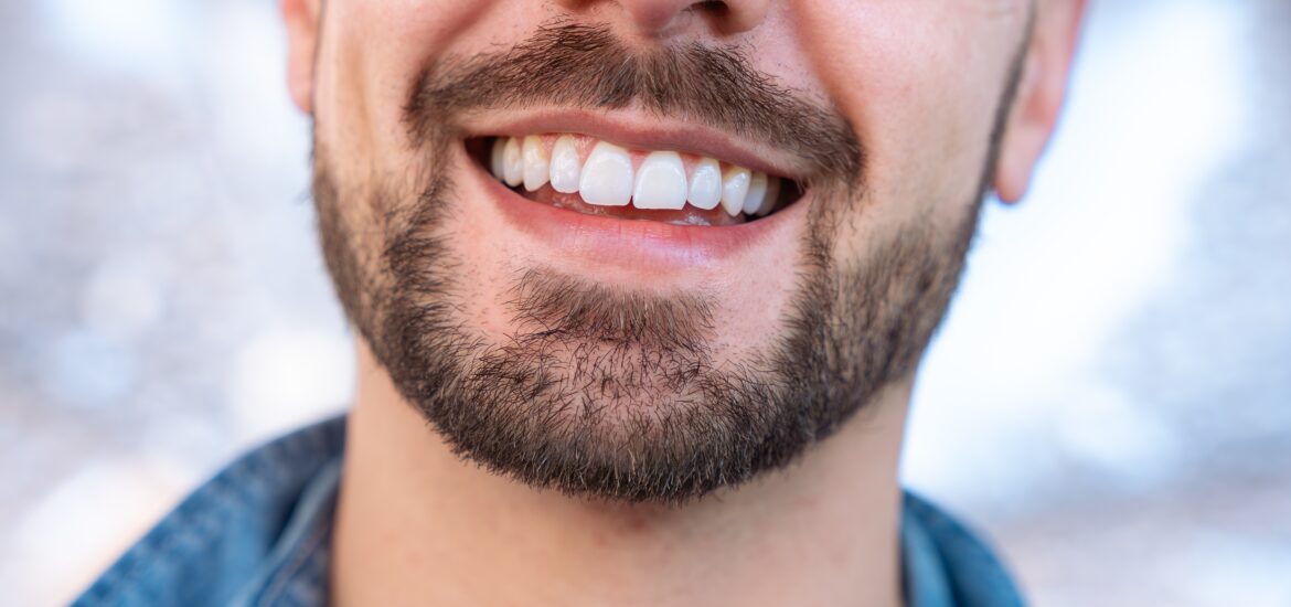 closeup of a man smiling, perfect white teeth